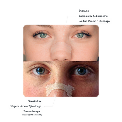 Airway Nasal Strips